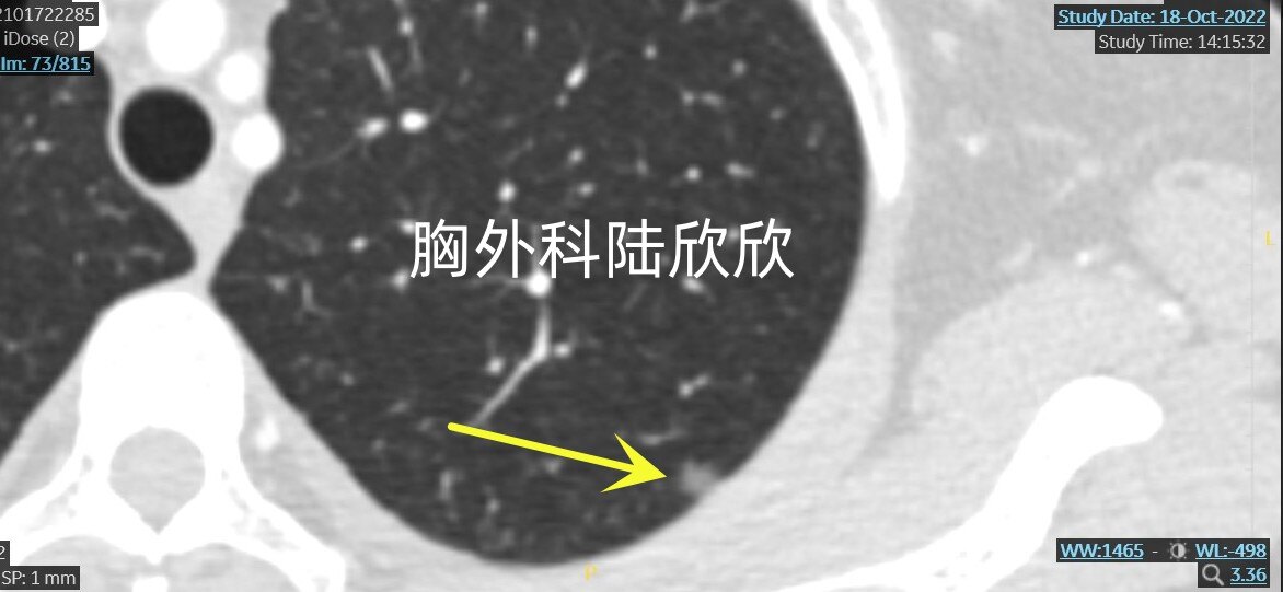 左上1薄层73放大水印.jpg