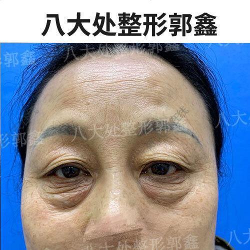 圖文圖片