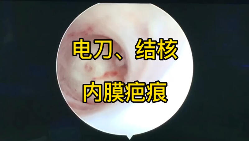 視頻封面