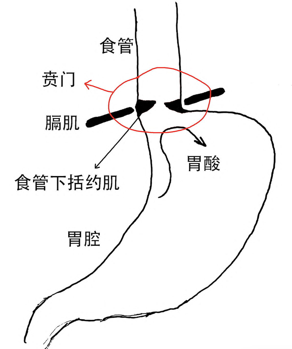 贲门示意图_副本.png