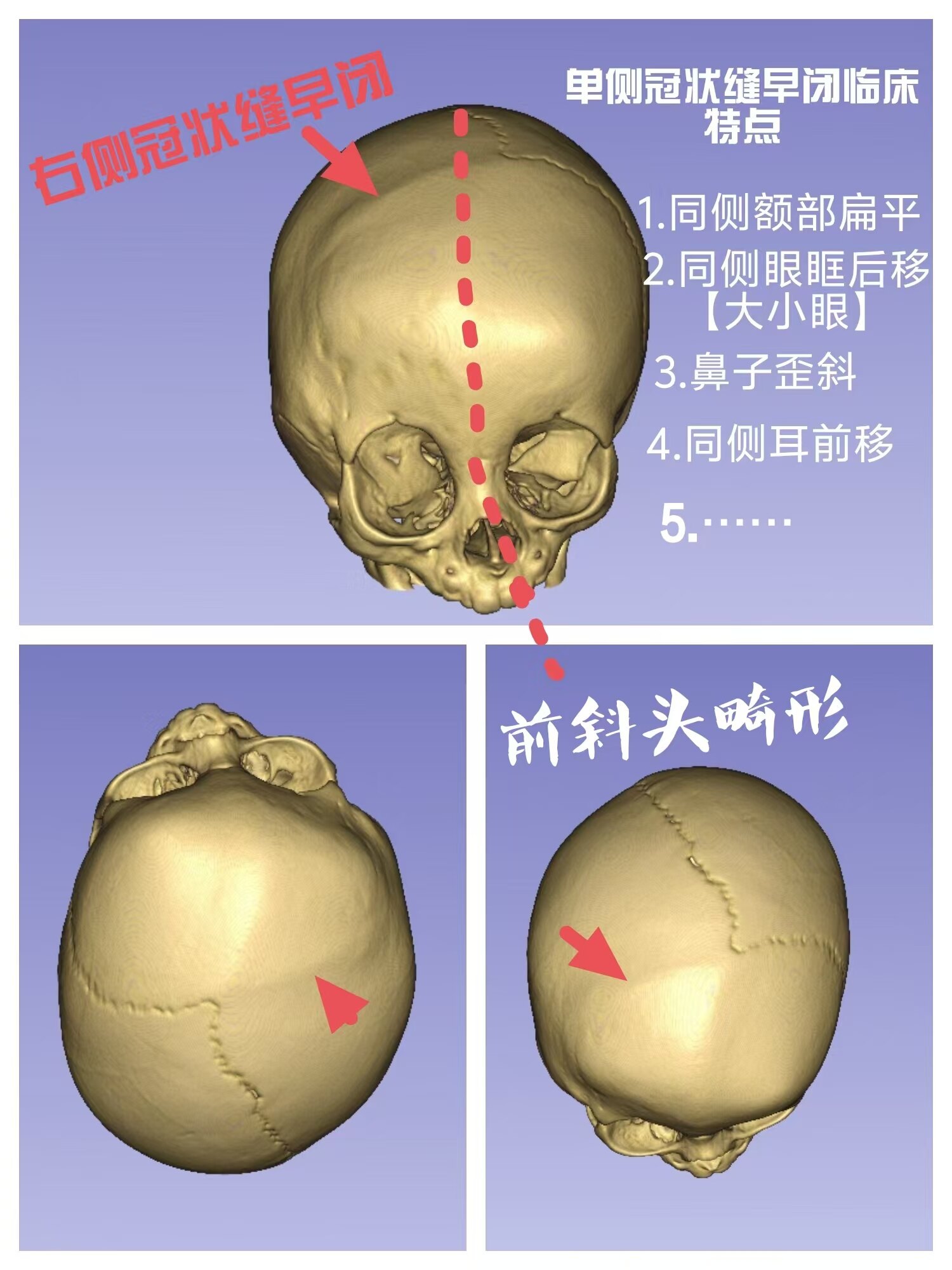 圖文圖片