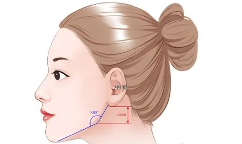 为什么下颌角手术一定要在有资质的医院进行