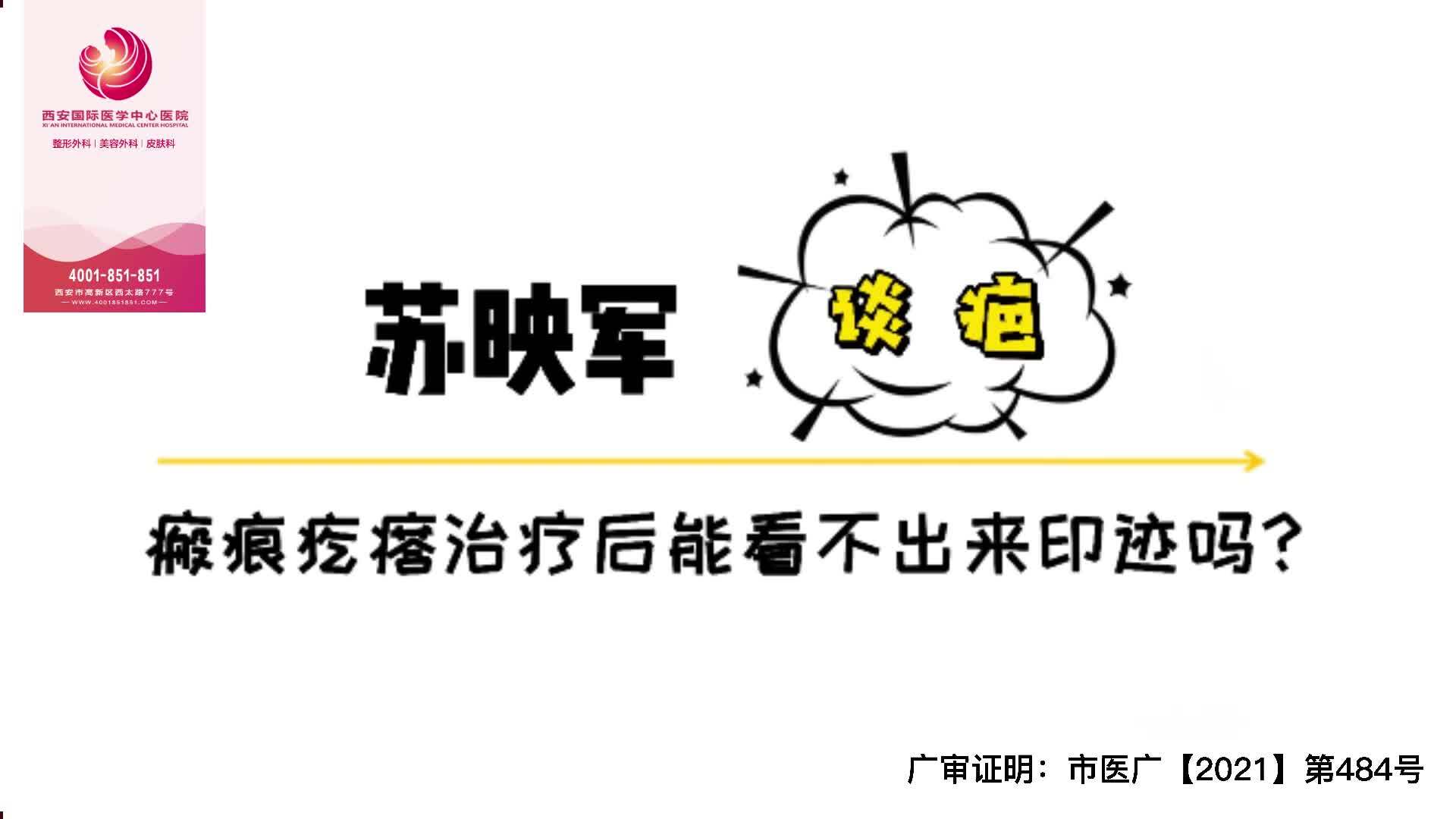 視頻封面