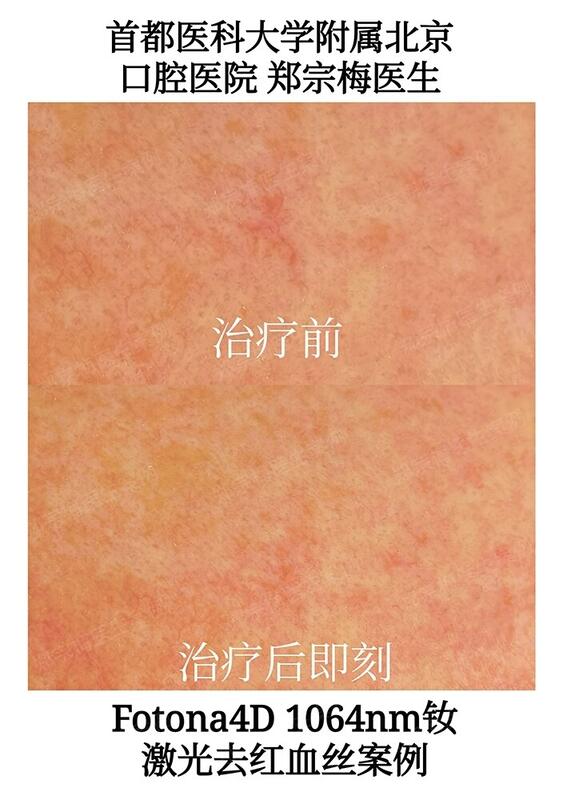 圖文圖片