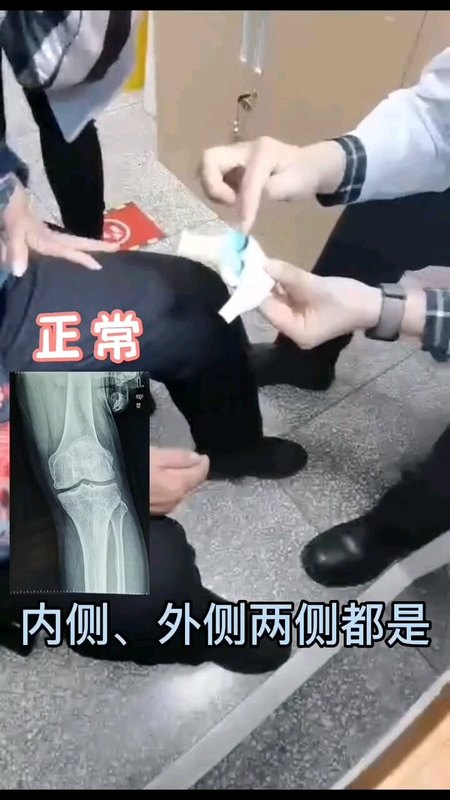 視頻封面