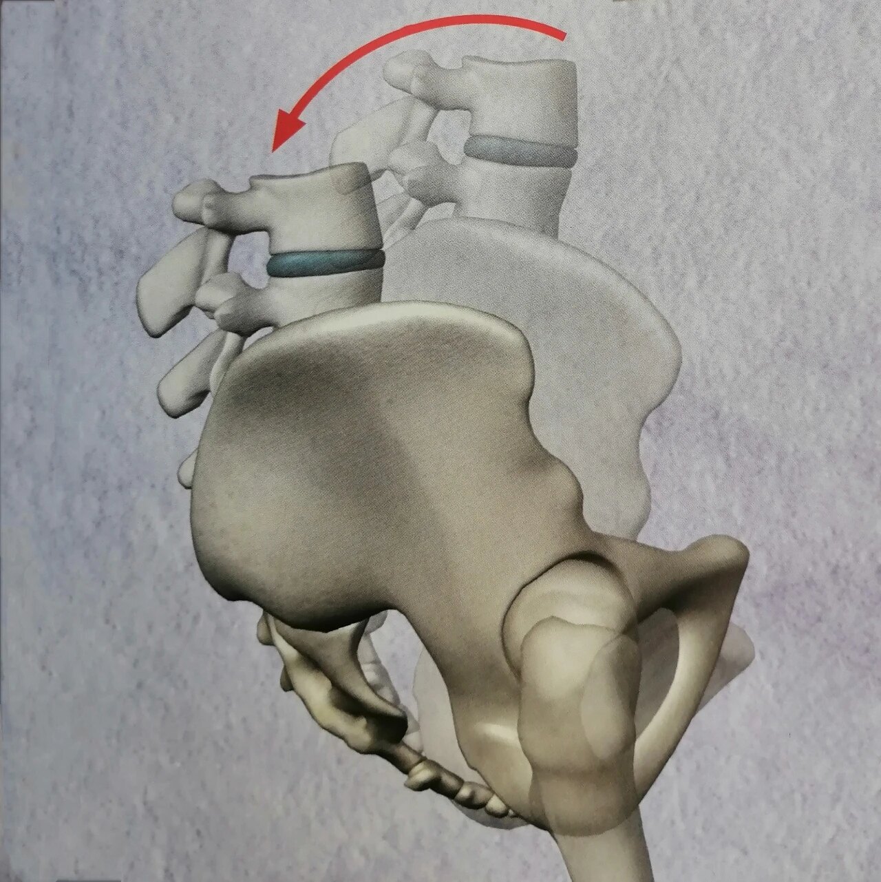 1,骨盆后倾是如何发生的?