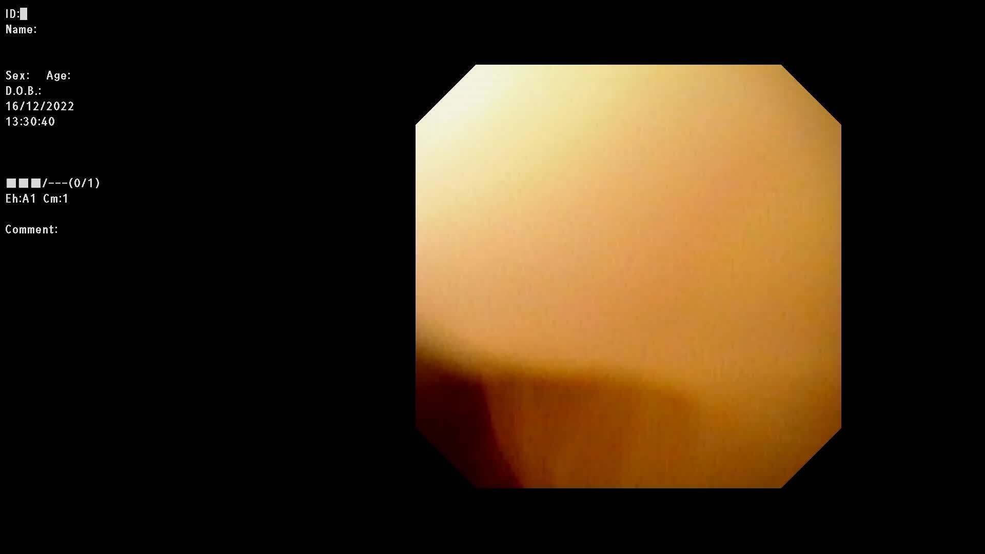 视频封面图