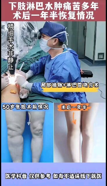 視頻封面