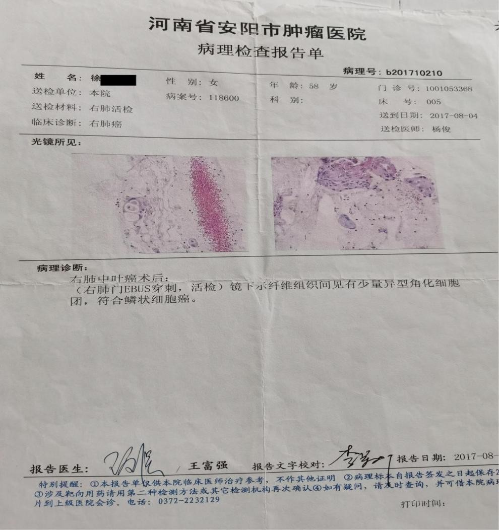 肺癌活检报告图片