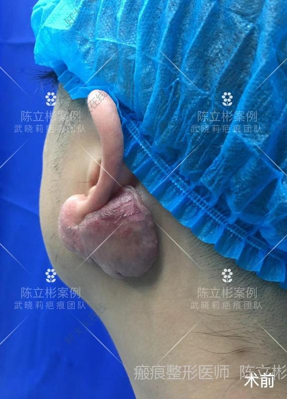 圖文圖片