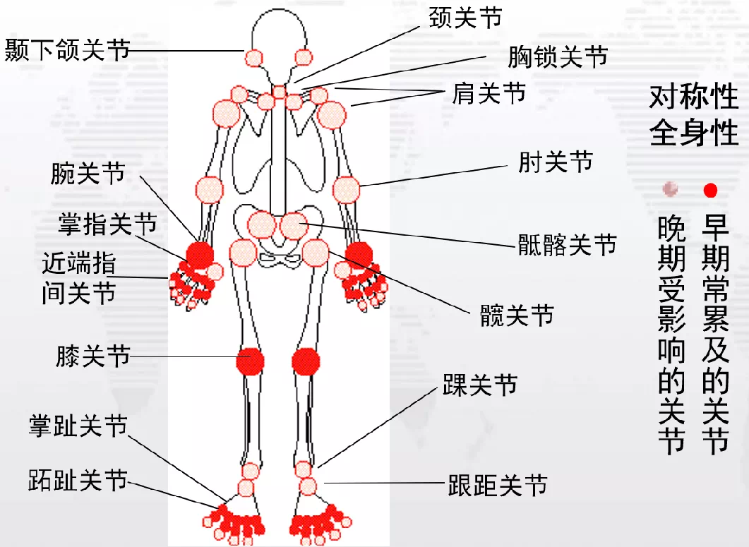 全身关节名称示意图图片