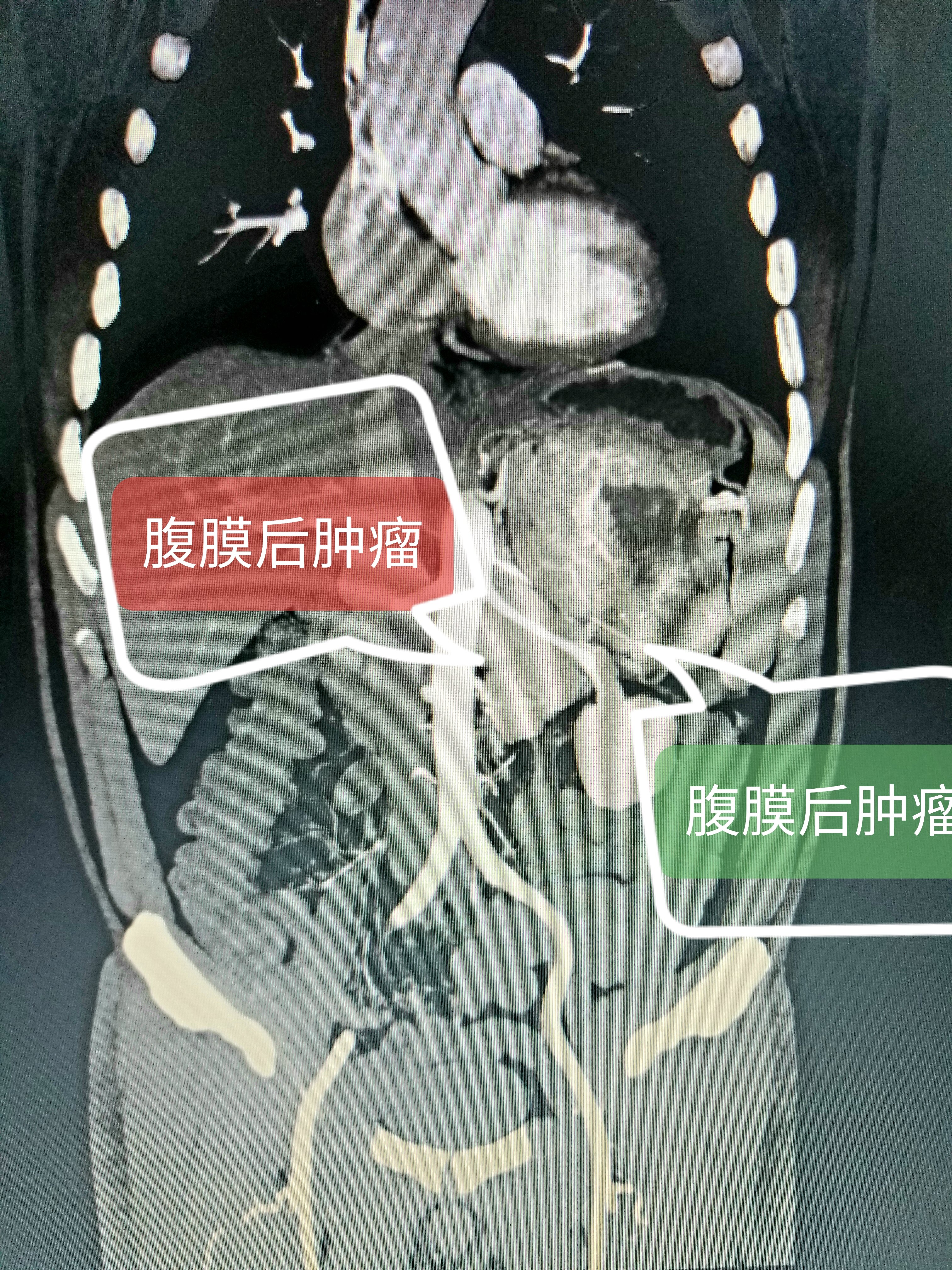 微信图片_20201218071240.jpg