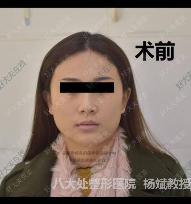 圖文圖片