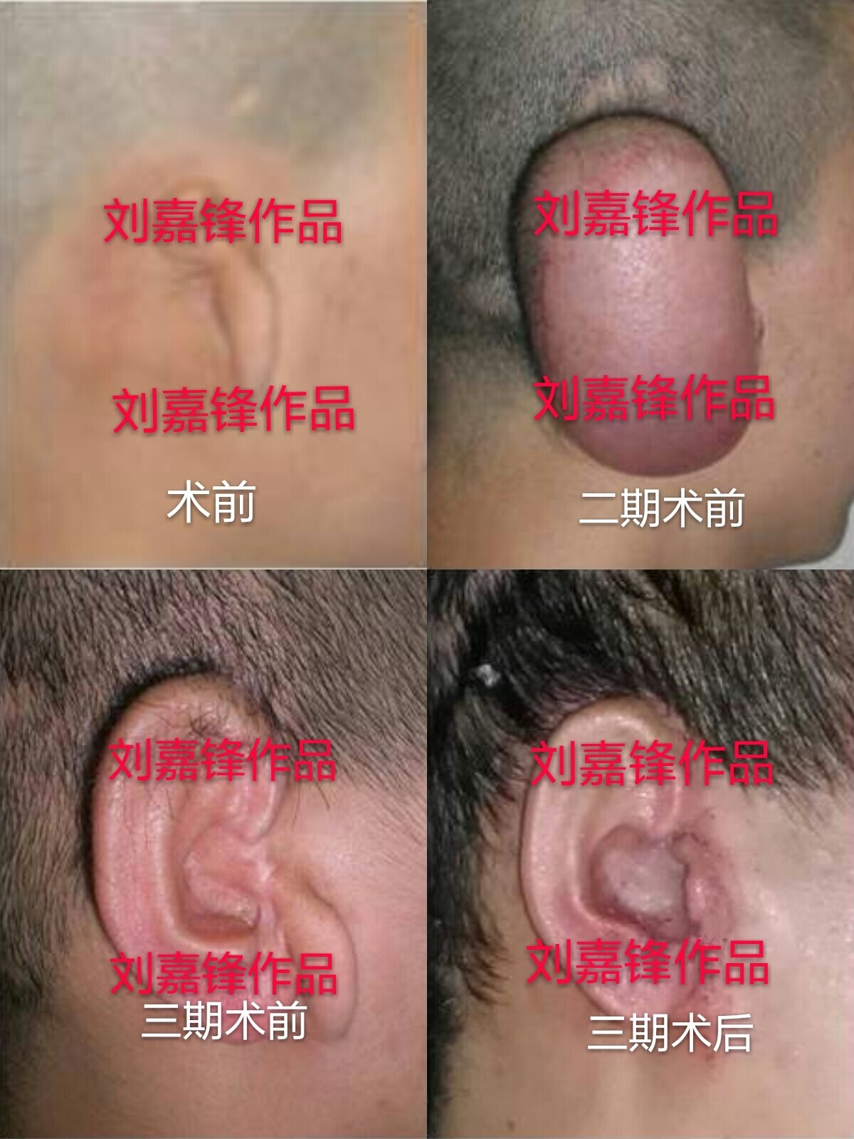 圖文圖片