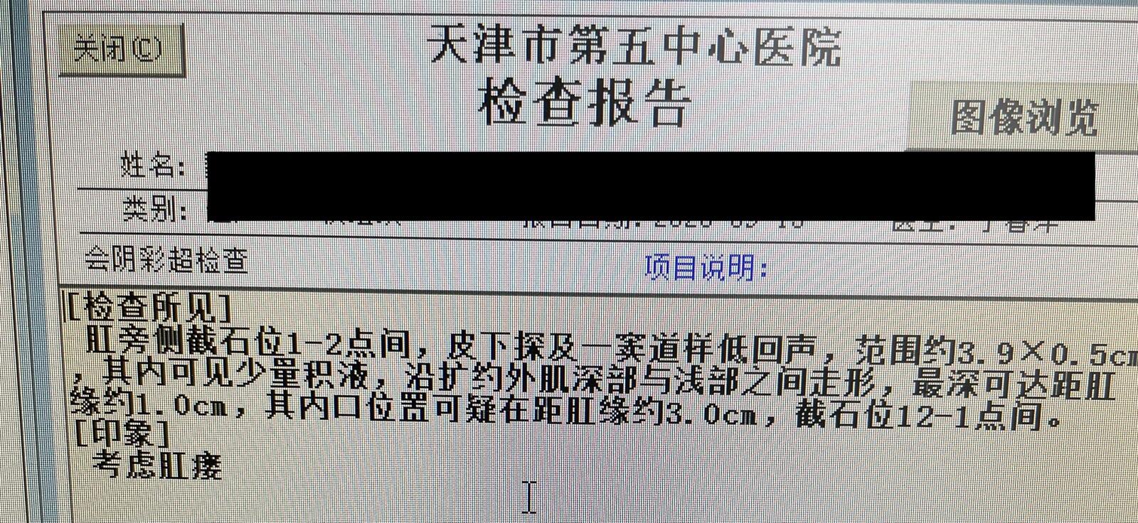 圖一是:臨床照片,左側肛周黑色圓圈內可以一個皮膚竇道口;圖二是:超聲