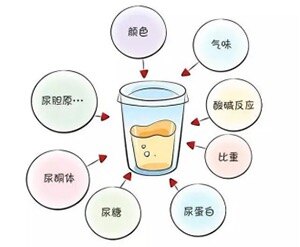 教你看化验单:3分钟看懂“尿常规”报告单_尿常规_尿常规介绍 - 好大夫在线