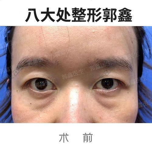 圖文圖片
