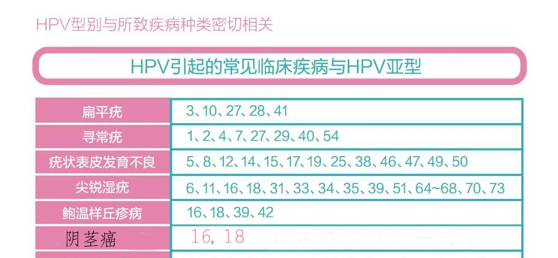 男性也会感染hpv甚至患癌症状有哪些