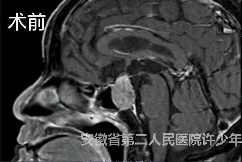 圖文圖片