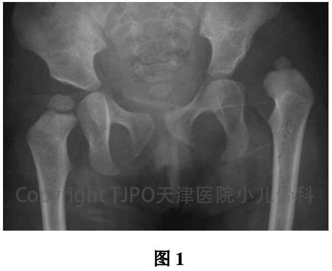 圖文圖片