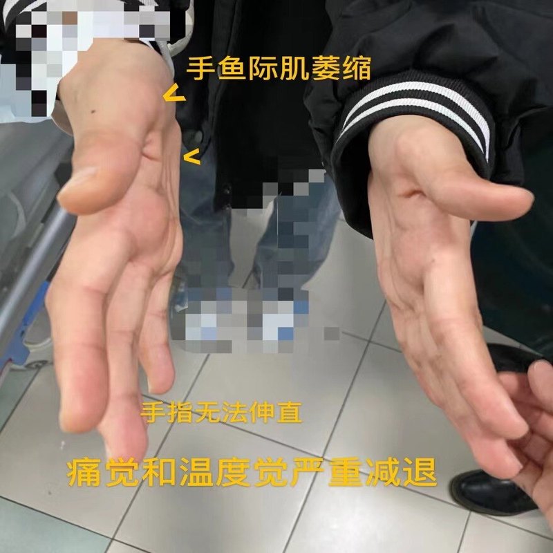 圖文圖片