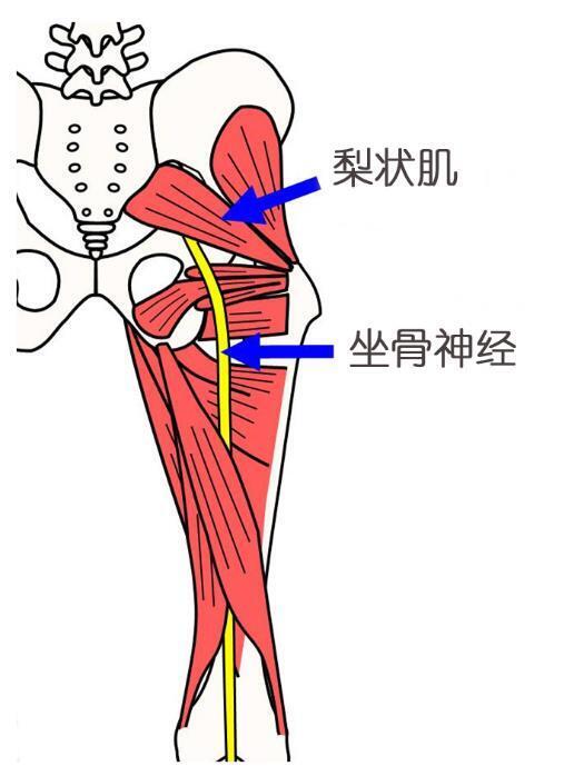 梨状肌ct解剖位置图图片