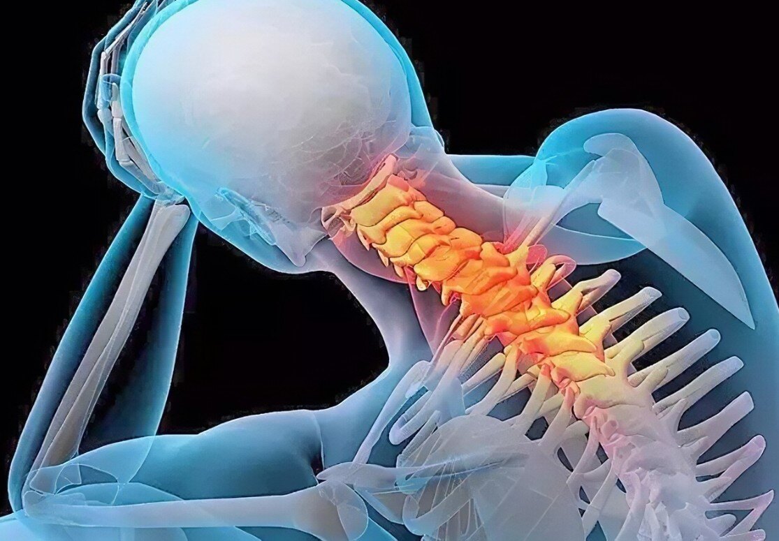 颈椎病的位置示意图图片