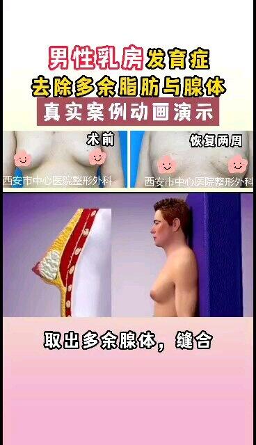 視頻封面