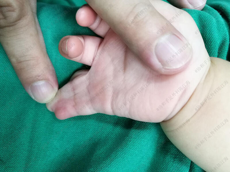 圖文圖片