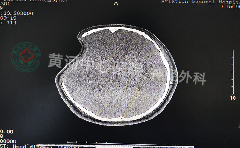 圖文圖片