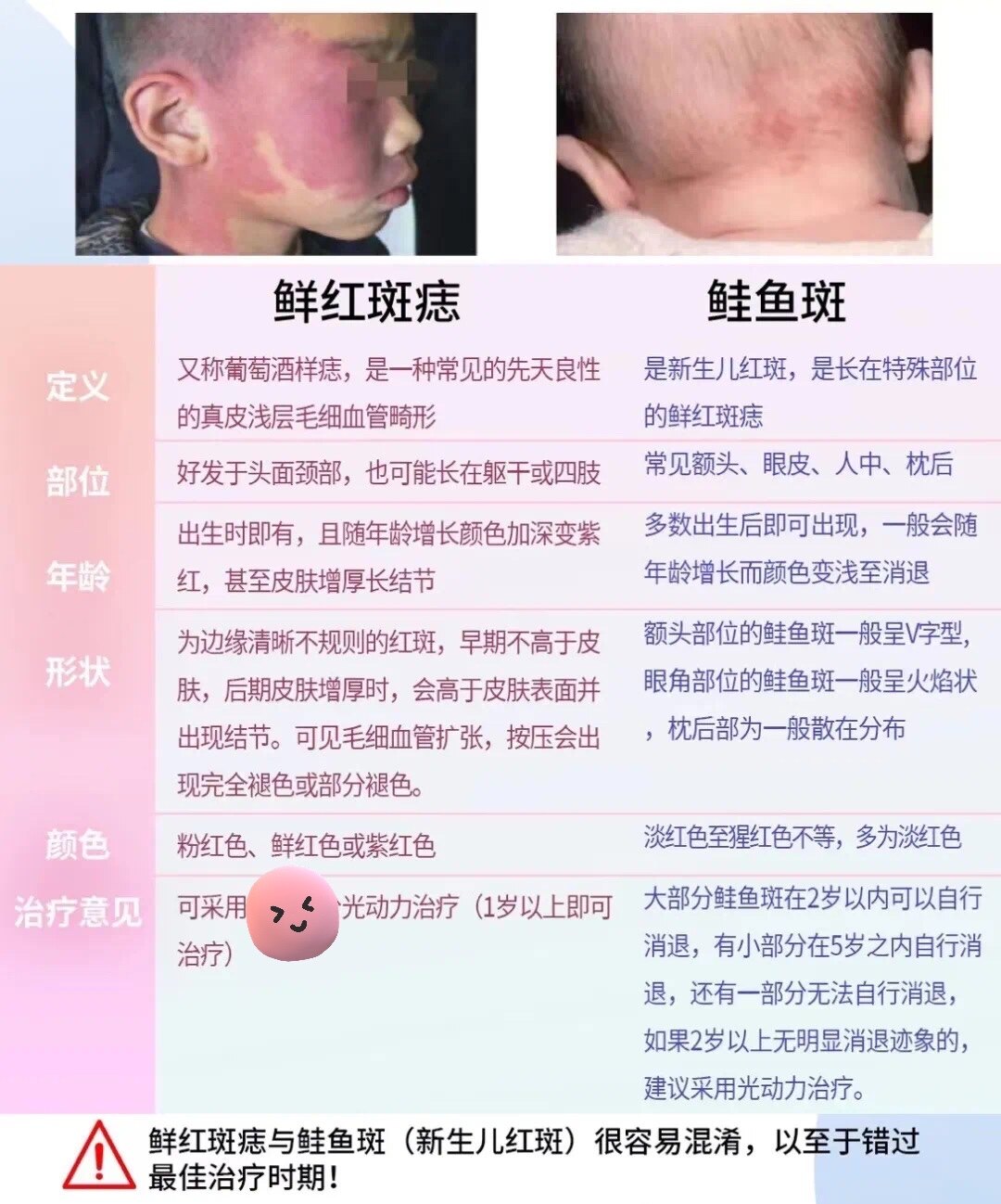 鲜红斑痣红胎记是否一定要治疗看完以下几个方面秒懂