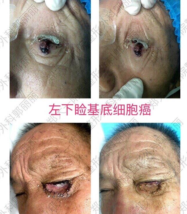 圖文圖片