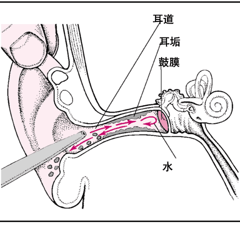 耳科趙醫生為頭條號簽約作者, 本文首發於今日頭條.