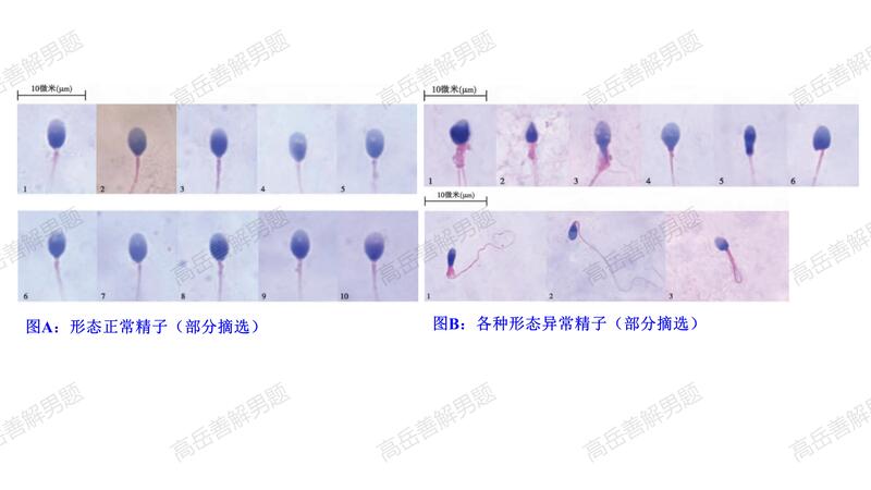 图：各种形态正常、异常精子（部分摘选）.jpg