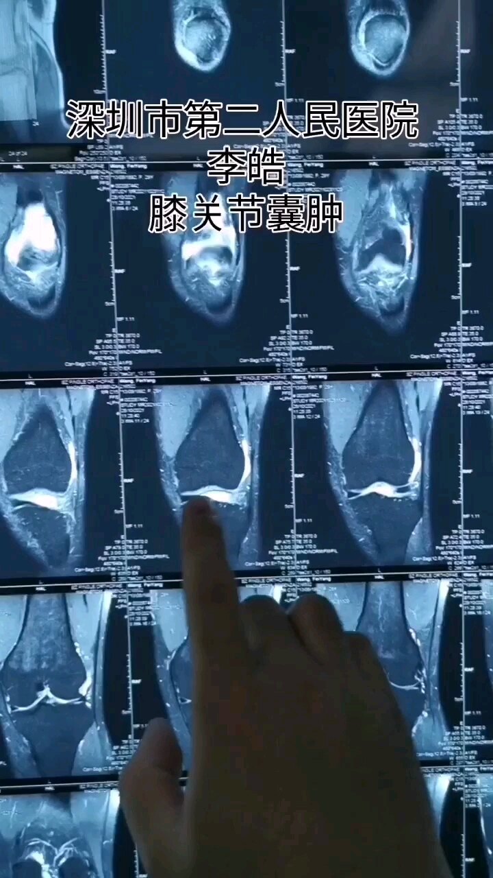 默认图片