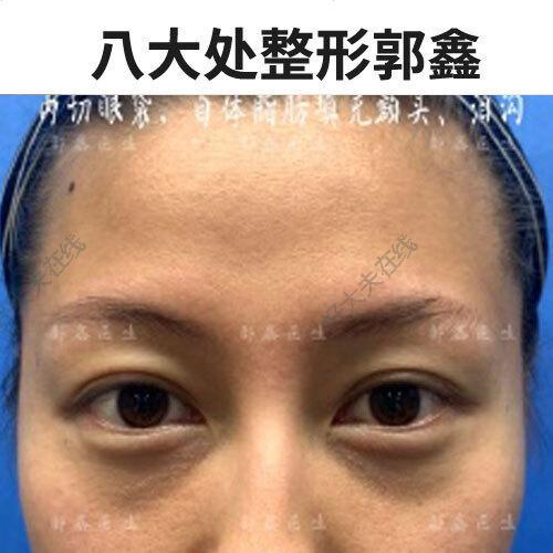 圖文圖片