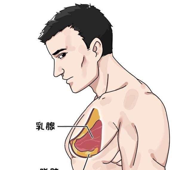 男性乳房发育症乳腺图片