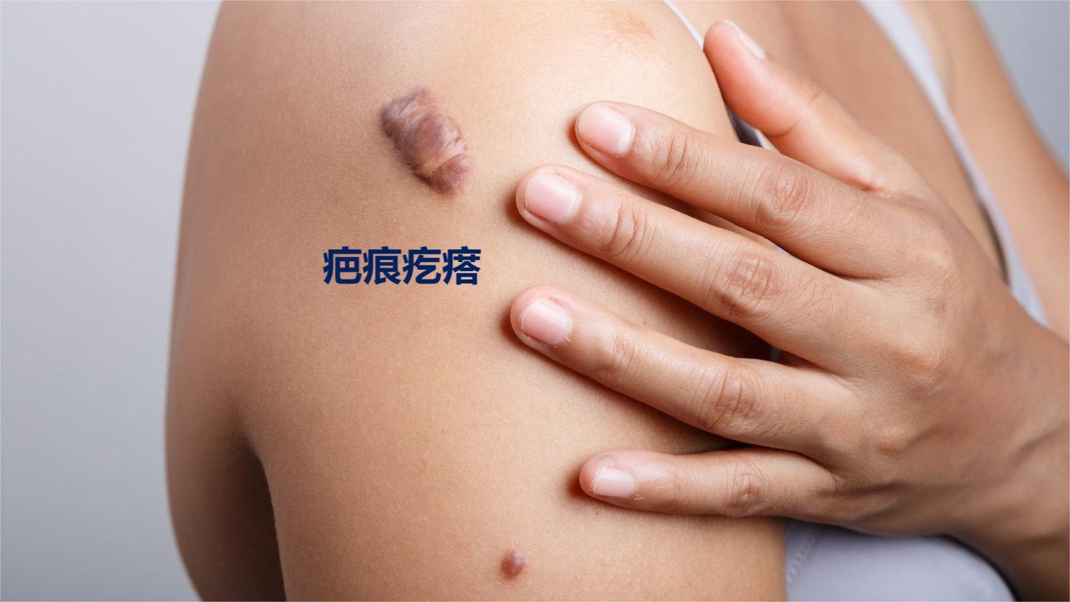 Keloid scars瘢痕疙瘩.jpg