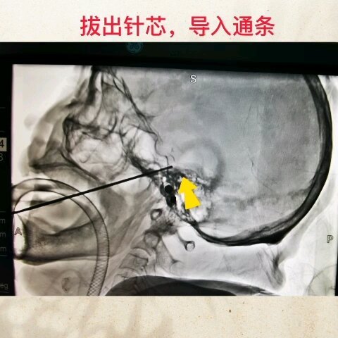 視頻封面