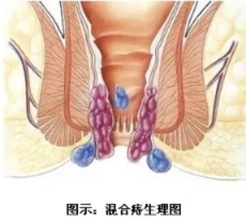 圖文圖片