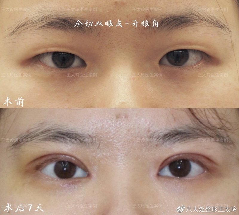 圖文圖片
