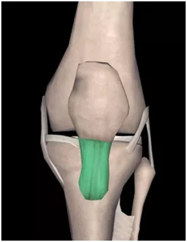 膝关节痛——髌尖末端病