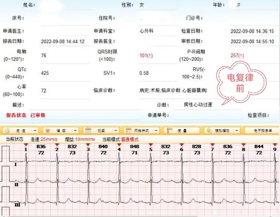 复律前心电图.jpg
