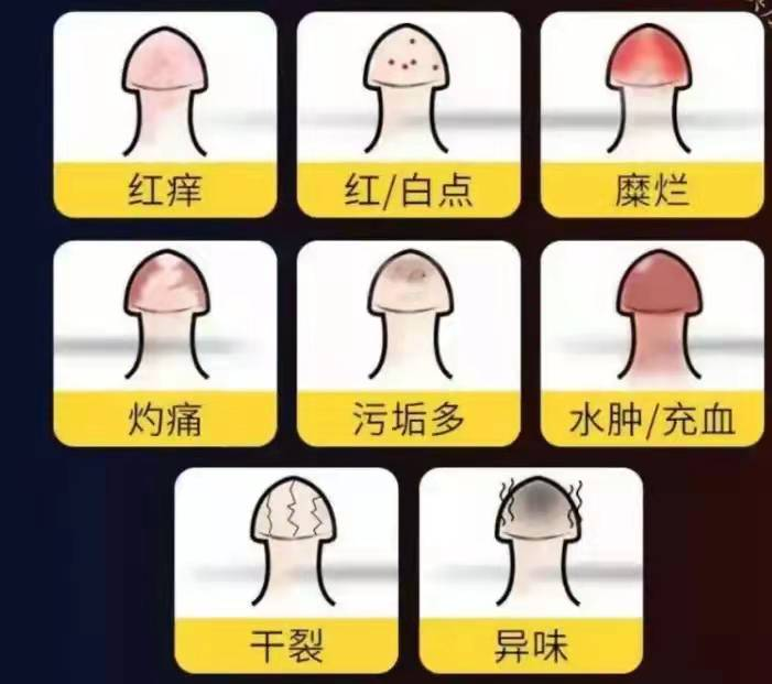 没有一个男人不在乎自己的丁丁!