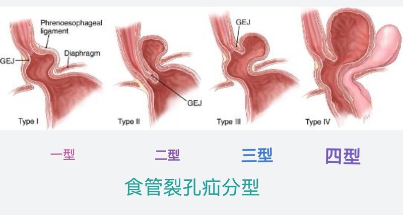 圖文圖片