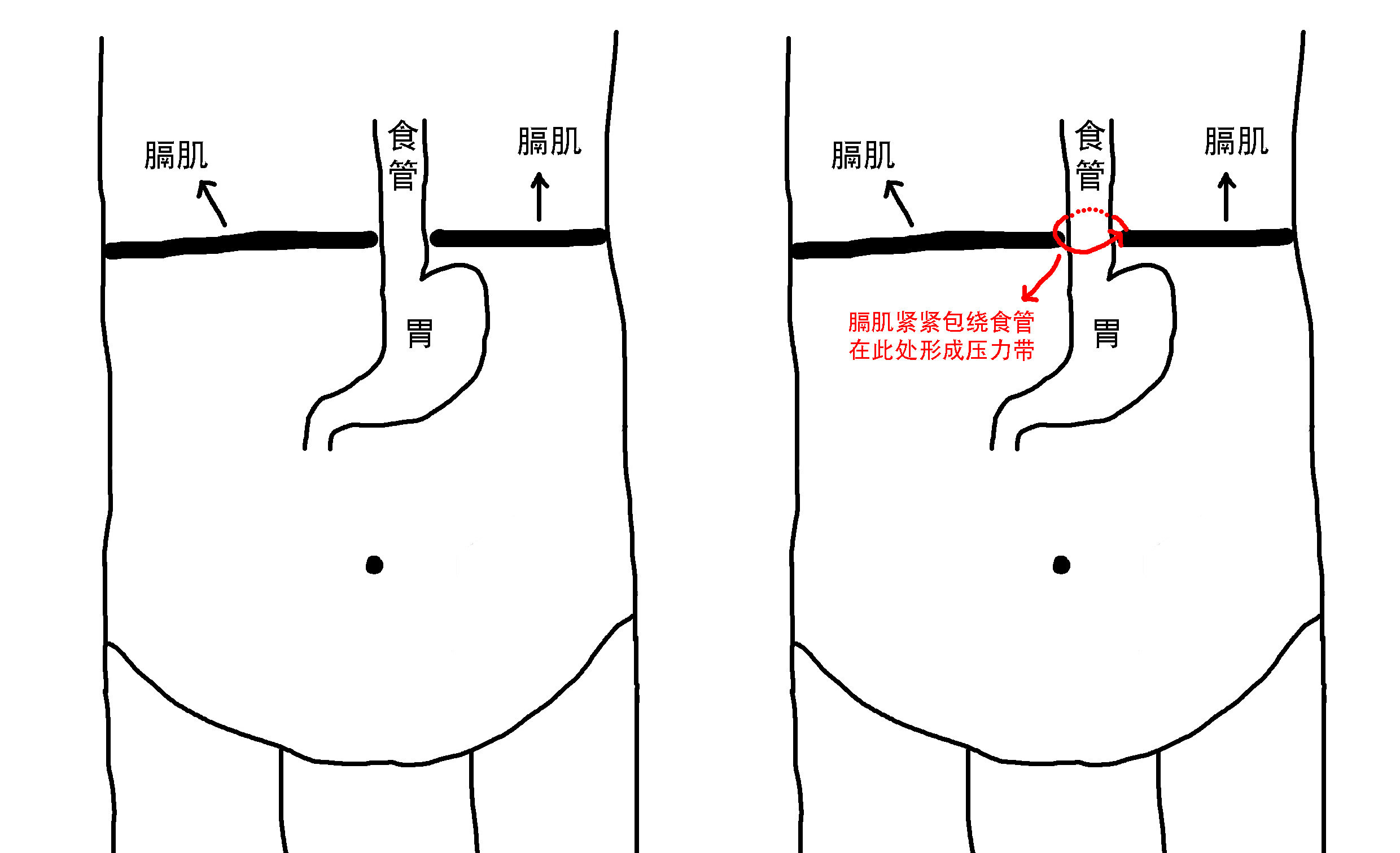 压力带副本.jpg