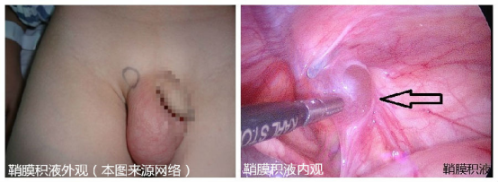 圖文圖片