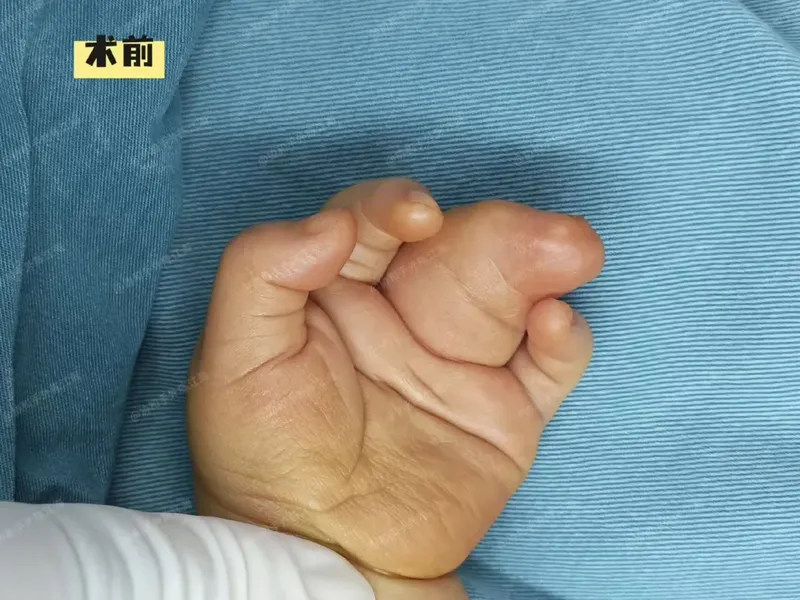 圖文圖片