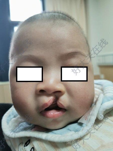 圖文圖片