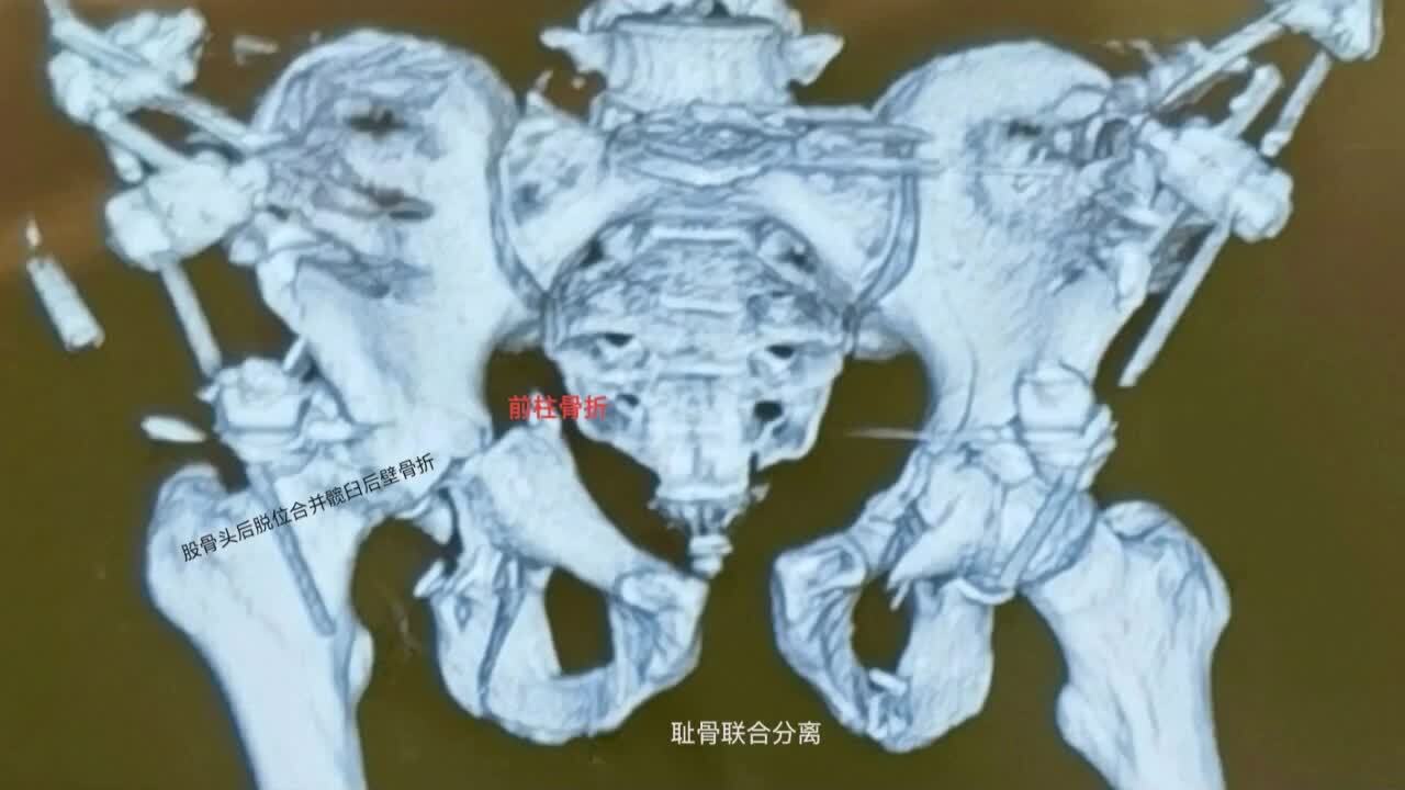 視頻封面